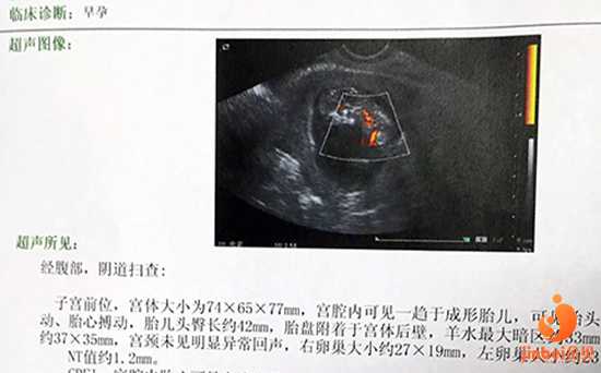 西安最好的代孕中心,【昆华医院做供卵试管婴儿吗】和很多人一样，提前三个